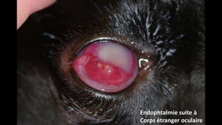 Endophtalmie suite à
Corps étranger oculaire

 