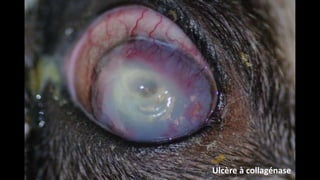 Ulcère à collagénase

 