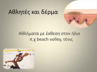 Αθλητές και δέρμα
Αθλήματα με έκθεση στον ήλιο
π.χ beach volley, τένις
 