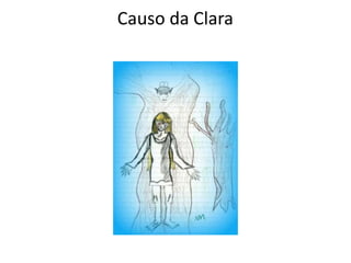 Causo da Clara
 