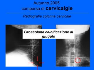 Piantoni Luca. L’ endocrinologo e la diarrea | PPT