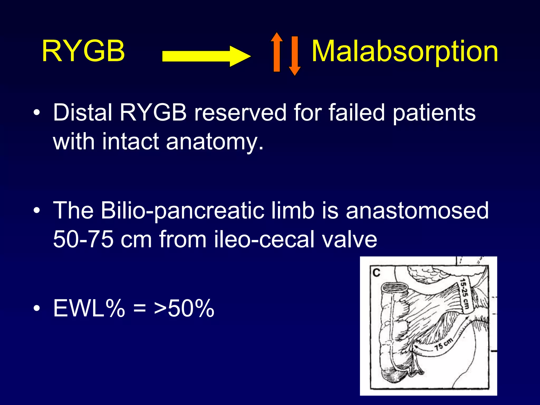 Distal Bypass: 75 cm common channelBrolin et al. J Gastrointest Surg 2002;6:195-205Distal Gastric Bypass