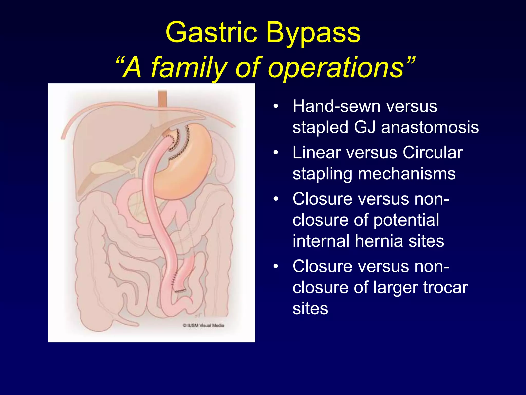 Gastric Bypass“A family of operations”Hand-sewn versus stapled GJ anastomosisLinear versus Circular stapling mechanismsClosure versus non-closure of potential internal hernia sitesClosure versus non-closure of larger trocar sites