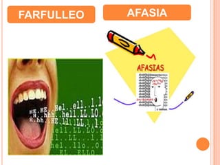 FARFULLEO AFASIA
 