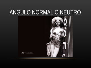 ÁNGULO NORMAL O NEUTRO 