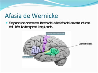 Afasia de Wernicke Se produce como resultado de la lesión de las estructuras del  lóbulo temporal izquierdo. Zona de afasia  
