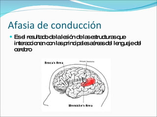 Afasia de conducción Es el resultado de la lesión de las estructuras que interaccionan con las principales aéreas del lenguaje del cerebro 