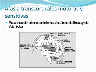 Afasia transcorticales motoras y sensitivas Resultado de lesiones próximas a las áreas de Broca y de Wernicke 