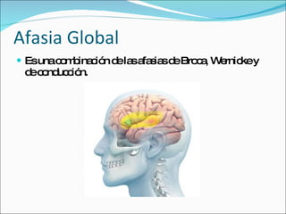 Afasia Global Es una combinación de las afasias de Broca, Wernicke y de conducción. 