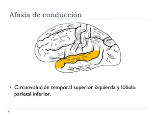 Afasia de conducción  Circunvolución temporal superior izquierda y lóbulo parietal inferior. 