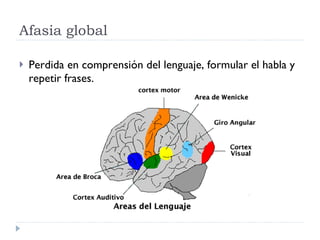 Afasia global Perdida en comprensión del lenguaje, formular el habla y repetir frases. 