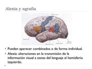 Alexia y agrafia Pueden aparecer combinados o de forma individual. Alexia: alteraciones en la transmisión de la información visual a zonas del lenguaje al hemisferio izquierdo. 