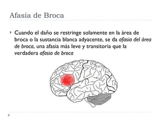 Afasia de Broca Cuando el daño se restringe solamente en la área de broca o la sustancia blanca adyacente, se da  afasia del área de broca , una afasia más leve y transitoria que la verdadera  afasia de broca 