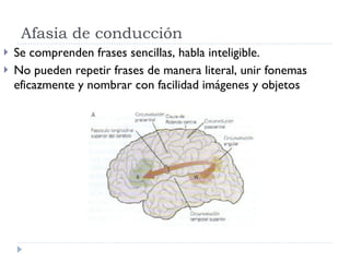 Afasia de conducción Se comprenden frases sencillas, habla inteligible. No pueden repetir frases de manera literal, unir fonemas eficazmente y nombrar con facilidad imágenes y objetos  
