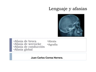 Lenguaje y afasias ,[object Object],[object Object],[object Object],[object Object],Juan Carlos Correa Herrera. ,[object Object],[object Object]