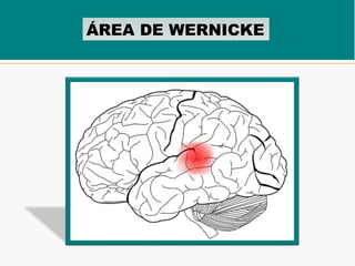 ÁREA DE WERNICKE
 
