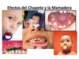 Efectos del Chupete y la Mamadera
 