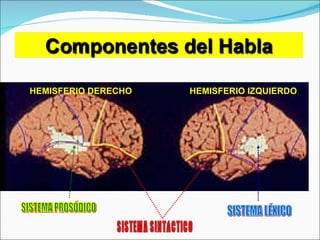 HEMISFERIO DERECHO HEMISFERIO IZQUIERDO SISTEMA SINTÁCTICO SISTEMA PROSÓDICO SISTEMA LÉXICO 