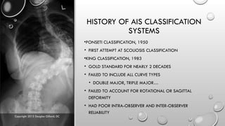 Lenke Types Lenke Classification for Adolescent Idiopathic Scoliosis (AIS) | PPTX