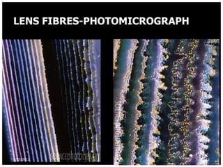 LENS FIBRES-PHOTOMICROGRAPH




8/25/2012                     12
 