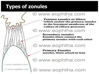 Types of zonules




8/25/2012          23
 