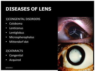 DISEASES OF LENS
1)CONGENITAL DISORDERS
• Coloboma
• Lenticonus
• Lentiglobus
• Microspherophalus
• Mittendorf dot

2)CATARACTS
• Congenital
• Acquired

8/25/2012                47
 