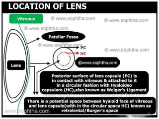 LOCATION OF LENS




8/25/2012          5
 