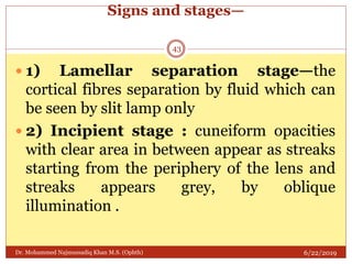 Lens Separation Example Lens & Cataract | PPTX