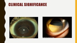 CLINICAL SIGNIFICANCE
 