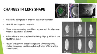 Lens Arch Shape lens.pptx