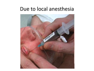 Due to local anesthesia
 