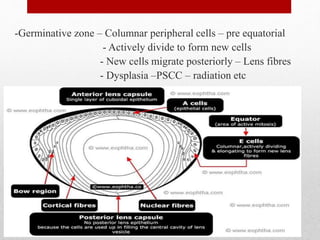 -Germinative zone – Columnar peripheral cells – pre equatorial
- Actively divide to form new cells
- New cells migrate posteriorly – Lens fibres
- Dysplasia –PSCC – radiation etc
13
 