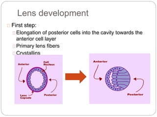 Lens and cataract | PPTX