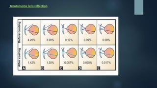 troublesome lens reflection
 