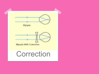 Correction
 