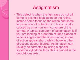 Astigmatism
 This defect is when the light rays do not all
come to a single focal point on the retina,
instead some focus on the retina and some
focus in front of or behind it. This is usually
caused by a non-uniform curvature of the
cornea. A typical symptom of astigmatism is if
you are looking at a pattern of lines placed at
various angles and the lines running in one
direction appear sharp whilst those in other
directions appear blurred. Astigmatism can
usually be corrected by using a special
spherical cylindrical lens; this is placed in the
out-of-focus axis.
 