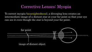 Corrective Lenses: Myopia
To correct myopia (nearsightedness), a diverging lens creates an
intermediate image of a distant star at your far point so that your eye
can see it even though the star is beyond your far point.
far point
image of distant object
 