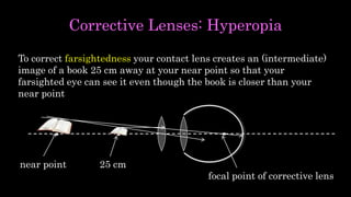 Corrective Lenses: Hyperopia
To correct farsightedness your contact lens creates an (intermediate)
image of a book 25 cm away at your near point so that your
farsighted eye can see it even though the book is closer than your
near point
near point 25 cm
focal point of corrective lens
 