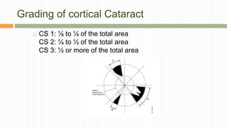 Anatomy and physiology of lens | PPTX
