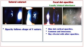 Lens Lecture Revision Arab Board HUCOM pptx