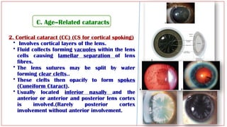 Lens Separation Lens lecture revision Arab Board HUCOM.pptx