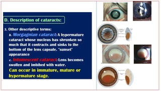 Lens lecture revision Arab Board HUCOM.pptx