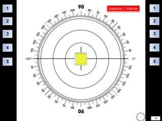 1   Superior / Inferior   1

2                         2

3                         3


4                         4


5                         5
 