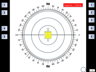 1   Superior / Inferior   1

2                         2

                          3


4                         4


5                         5
 
