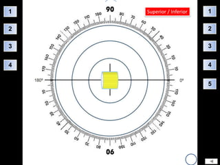 1   Superior / Inferior   1

2                         2

3                         3


4                         4


                          5
 