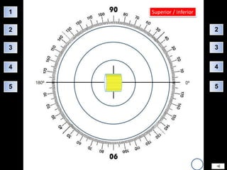 1   Superior / Inferior


2                         2

3                         3


4                         4


5                         5
 