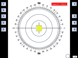 1   Superior / Inferior   1

2

3                         3


4                         4


5                         5
 