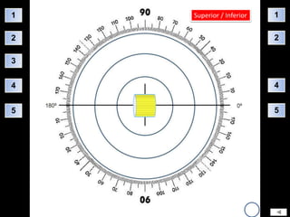 1   Superior / Inferior   1

2                         2

3


4                         4


5                         5
 