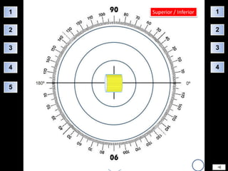 1   Superior / Inferior   1

2                         2

3                         3


4                         4


5
 