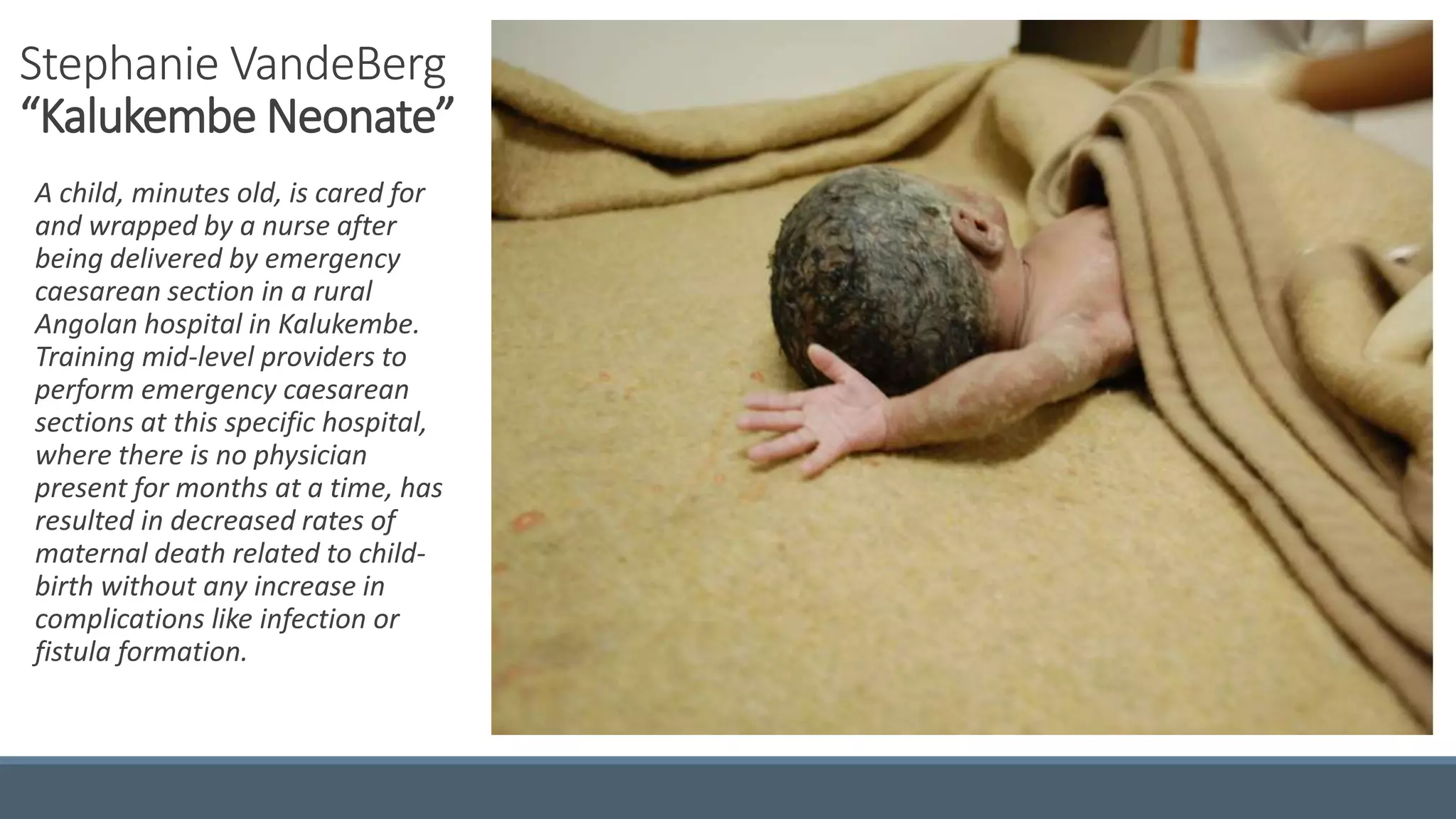 Stephanie VandeBerg
“Kalukembe Neonate”
A child, minutes old, is cared for
and wrapped by a nurse after
being delivered by emergency
caesarean section in a rural
Angolan hospital in Kalukembe.
Training mid-level providers to
perform emergency caesarean
sections at this specific hospital,
where there is no physician
present for months at a time, has
resulted in decreased rates of
maternal death related to child-
birth without any increase in
complications like infection or
fistula formation.
 